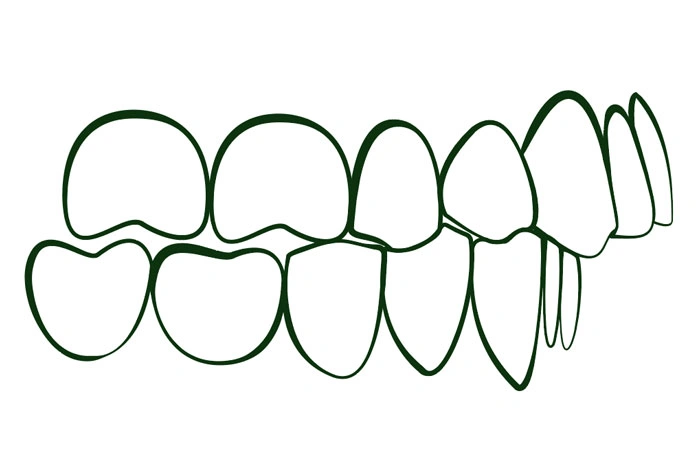 Oralys by DMI Ortodoncia Invisible