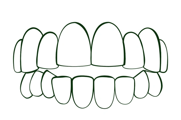 Oralys by DMI Ortodoncia Invisible