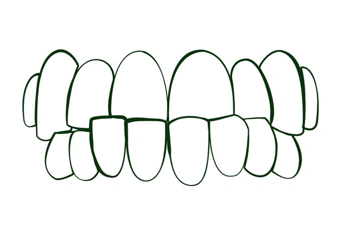 Oralys by DMI Ortodoncia Invisible