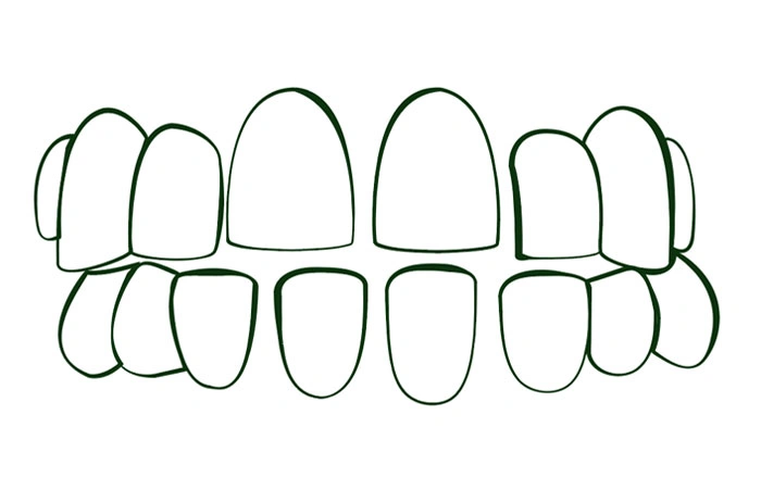Oralys by DMI Ortodoncia Invisible