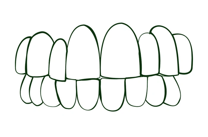 Oralys by DMI Ortodoncia Invisible